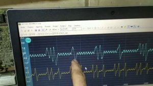 Автоэлектрик. Субару Легаси Не заводится. Искра есть и бензин  .Метки грм