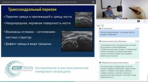 Бесплатный вебинар: Современные международные стандарты ультразвуковой диагностики локтевого сустава