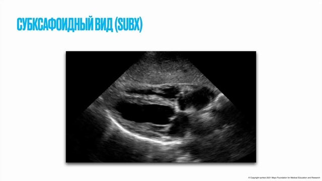 Как делать УЗИ если вы не умеете делать УЗИ (часть 2) смотреть онлайн