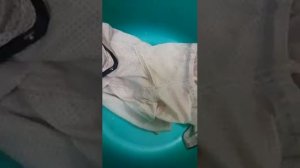 Супер способ из трех бюджетных средств отстирать желтые пятна под мышками