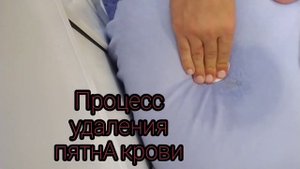 Удаление старого пятна крови