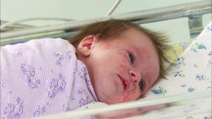 Недоношенные дети. Лечение с помощью стволовых клеток. Здоровье. Фрагмент выпуска от 27.11.2016