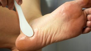 Домашняя мазь от натоптышей и сухих мозолей. Ухоженные пяточки за пару процедур