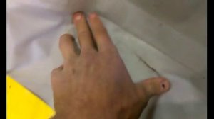 как правильно заклеить  большой порез