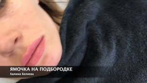 ЯМОЧКА на ПОДБОРОДКЕ