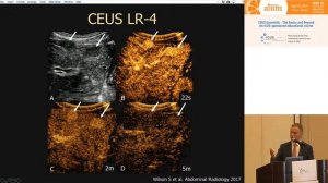 HCC Diagnosis and LI-RADS