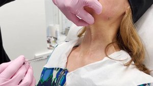 Хирург Николай Макеенко Зачем колоть в шею ботокс