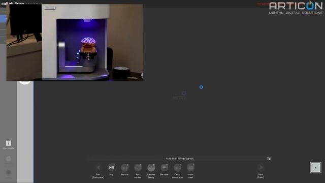 EXOCAD / СКАНИРОВАНИЕ ДИАГНОСТИЧЕСКИХ МОДЕЛЕЙ НА ЛАБОРАТОРНЫХ СКАНЕРАХ MEDIT T-SERIES - ARTICON