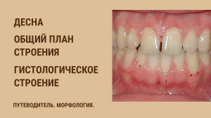 Десна. Общий план строения. Гистологическое строение