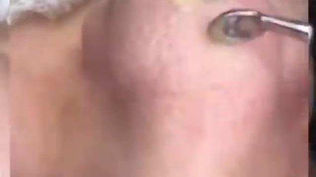 Чистка лица смотреть онлайн