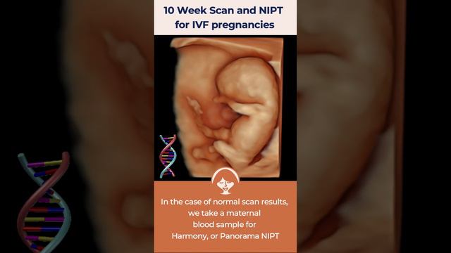 10 Week Scan and NIPT for IVF pregnancies