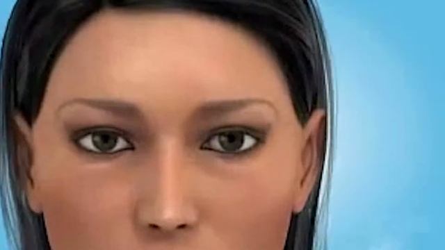 Botoks Uygulamaları Yüz İfadelerini Etkiler mi смотреть онлайн