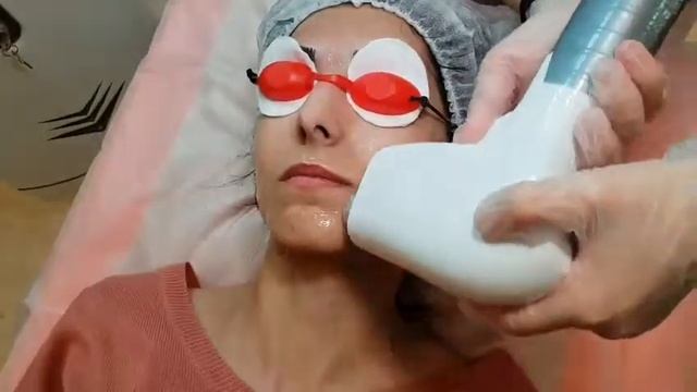 Как избавиться от волос на лице и теле? смотреть онлайн