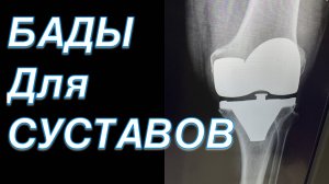 БАДЫ ДЛЯ СУСТАВОВ