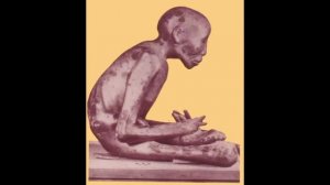 Топ живых мумий