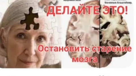 Делайте ЭТО и сохраните МОЗГ до глубокой старости молодым. Остановить старение мозга.