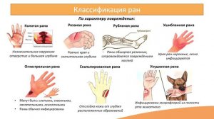 10.1. Раны. Раневые инфекции