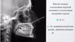 ТРГ- это просто. Шпаргалка. Основное.
