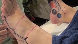 Аппликатор "Ляпко" Стельки и их механизмы действия на организм человека.