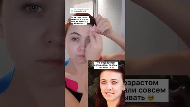 Нависшее веко смотреть онлайн