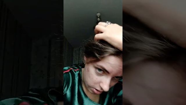 Моя история лечения АКНЕ 2021-2022гг. смотреть онлайн