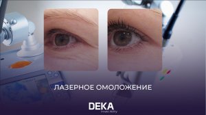 ЛАЗЕРНОЕ ОМОЛОЖЕНИЕ В ЛЕТНЕЕ ВРЕМЯ | DOT-THERAPY | DEKA