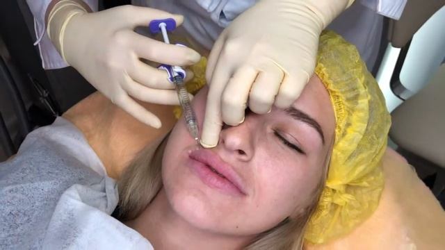 OLA - сеть салонов красоты №1 Коррекция губ. Врач-косметолог Н.Н.Голощапова смотреть онлайн