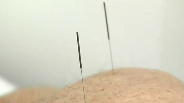 Лечение в Санатории Уссури - 2 смотреть онлайн