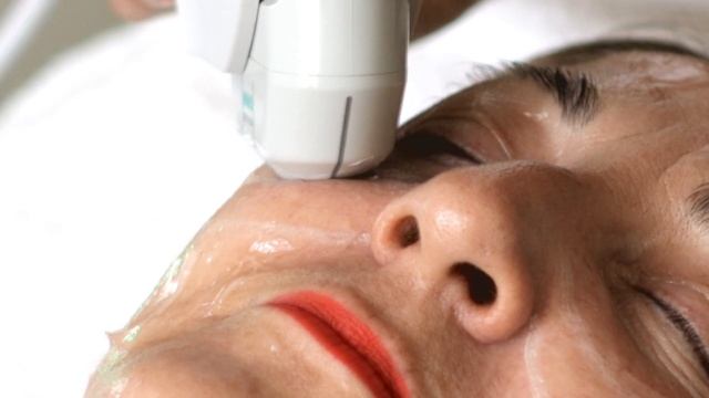 Ultherapy® Testimonio real - Lifting sin cirugía смотреть онлайн