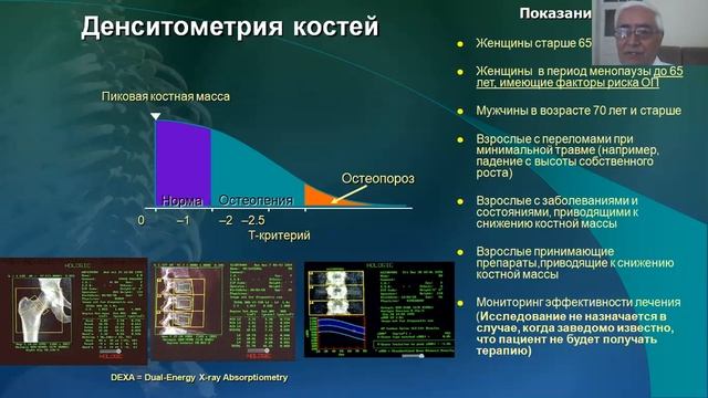 Как проводится денситометрия костей на остеопороз фото Остеопороз Профилактика остеопороза - смотреть видео онлайн от "Стрижки для самы