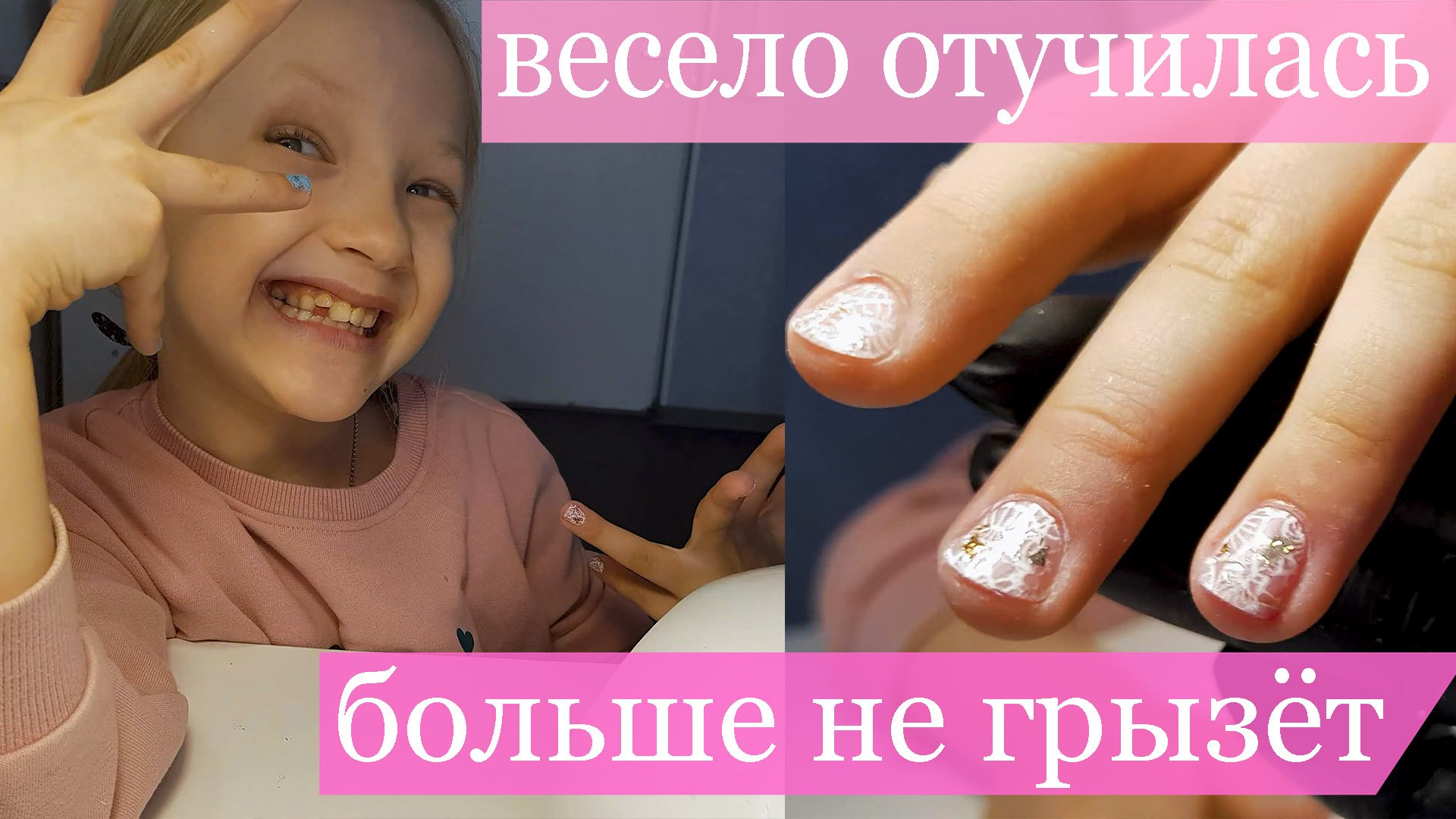 Видео маникюра на проблемных ногтях