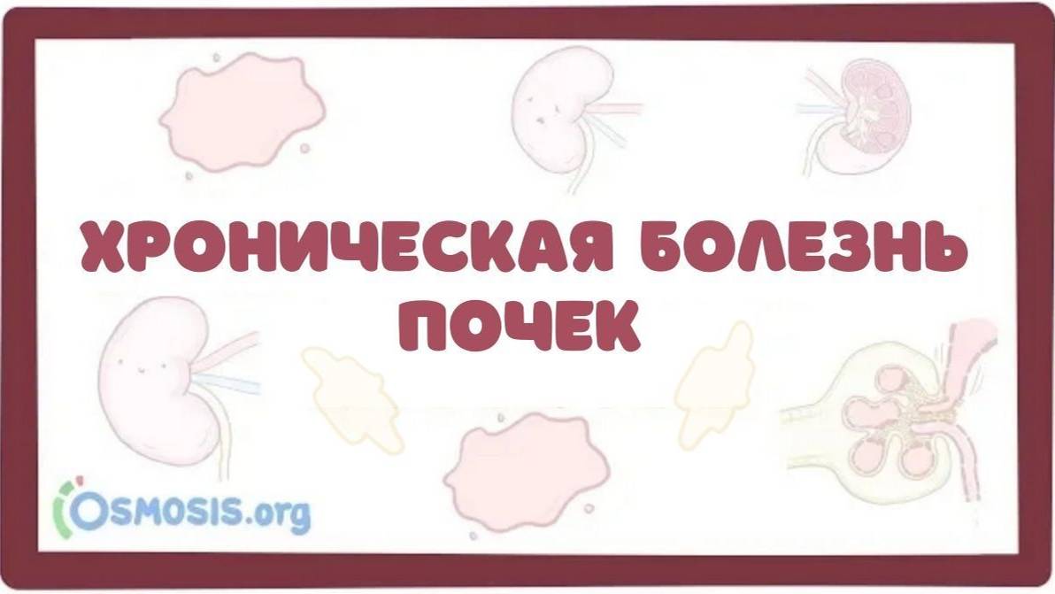 Хроническая Болезнь Почек (ХБП, ХПН) - причины, симптомы, клиника, лечение (лекция)