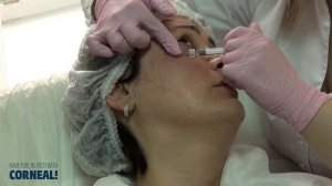 Коррекция периорбитальной области. Мастер-класс Лосевой О.А.