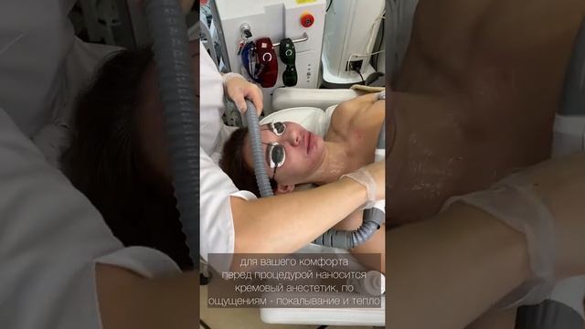 Лазерное фотоомоложение (ELOS: IPL + RF-лифтинг) смотреть онлайн