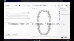 Exocad 3.1 Rijeka Full module Installation ||Telegram - @Johndoe7011 || WhatsApp - +15757881955 ||