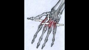 Червеобразные мышцы кисти  Musculi lumbricales