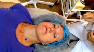 Криомассаж лица