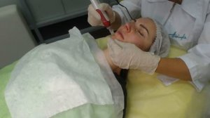 Фракционная мезотерапия