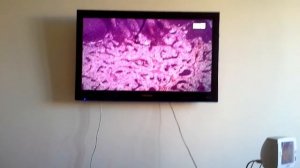 Гистология Тимус, Лимфоузел, Селезенка