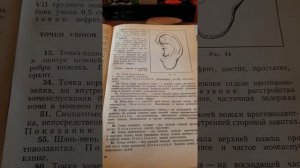 Почечная колика ,камень в мочеточнике