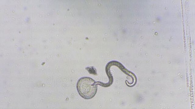 Я никогда не видел таких паразитов в организме человека? смотреть онлайн