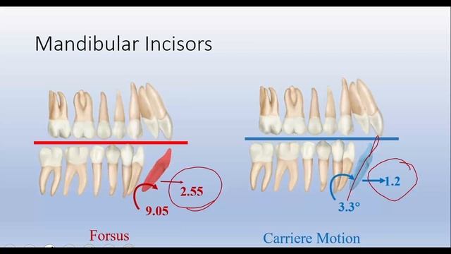Sagittal first - формула вашего успеха