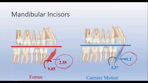 Sagittal first - формула вашего успеха