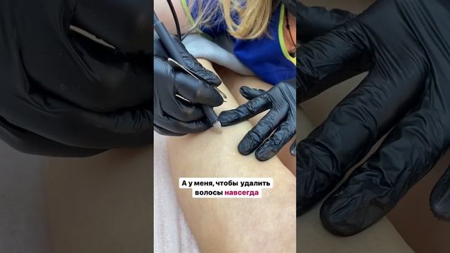 Приходи на электроэпиляцию, избавим от волос навсегда)) #электроэпиляция #электроэпиляциямосква
