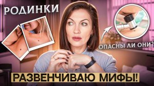 Опасны ли родинки? Развенчиваю мифы! Кто в группе риска и насколько он велик