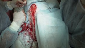 Удаление новообразования молочной железы у собаки.