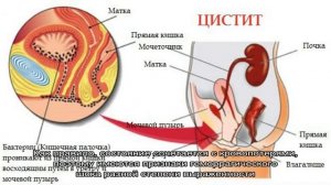 Почему болит в области мочевого пузыря