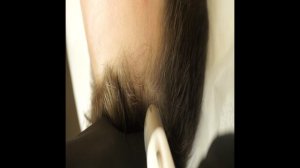 Процедура Dermadrop от сезонного выпадения волос
