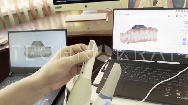 Отзыв владельца интраорального сканера Runyes после 3ех месяцев эксплуатации