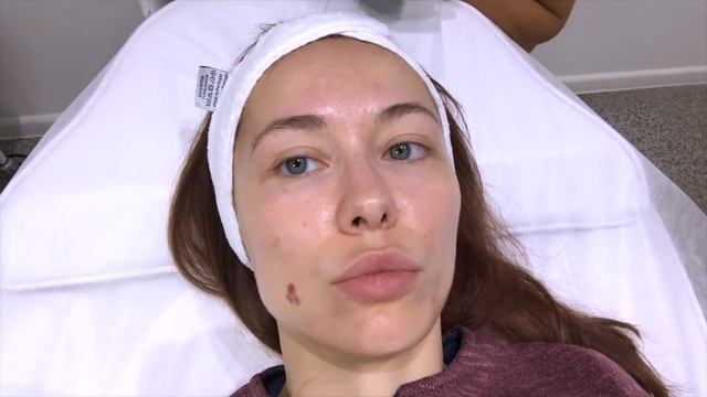 Докоррекция носослезки + Пилинг. Neauvia, Enerpeel смотреть онлайн